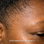 AMANYIA™ Advanced Hair Growth System