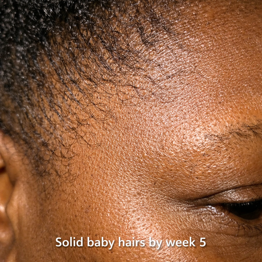 AMANYIA™ Advanced Hair Growth System